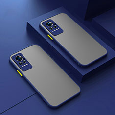 Silicone Transparent Frame Case Cover for Xiaomi Civi 1S 5G Blue