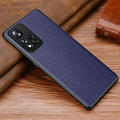 Soft Luxury Leather Snap On Case Cover DL1 for Xiaomi Mi 11i 5G (2022) Blue