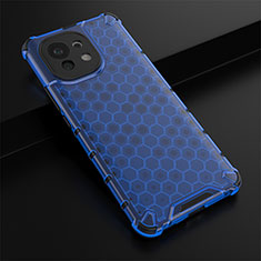 Ultra-thin Silicone Gel Soft Case 360 Degrees Cover C03 for Xiaomi Mi 11 5G Blue
